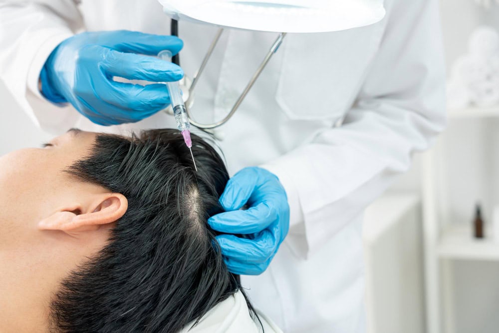 Ein männlicher Patient, der sich einer PRP-Behandlung in einer deutschen Haarklinik unterzieht.