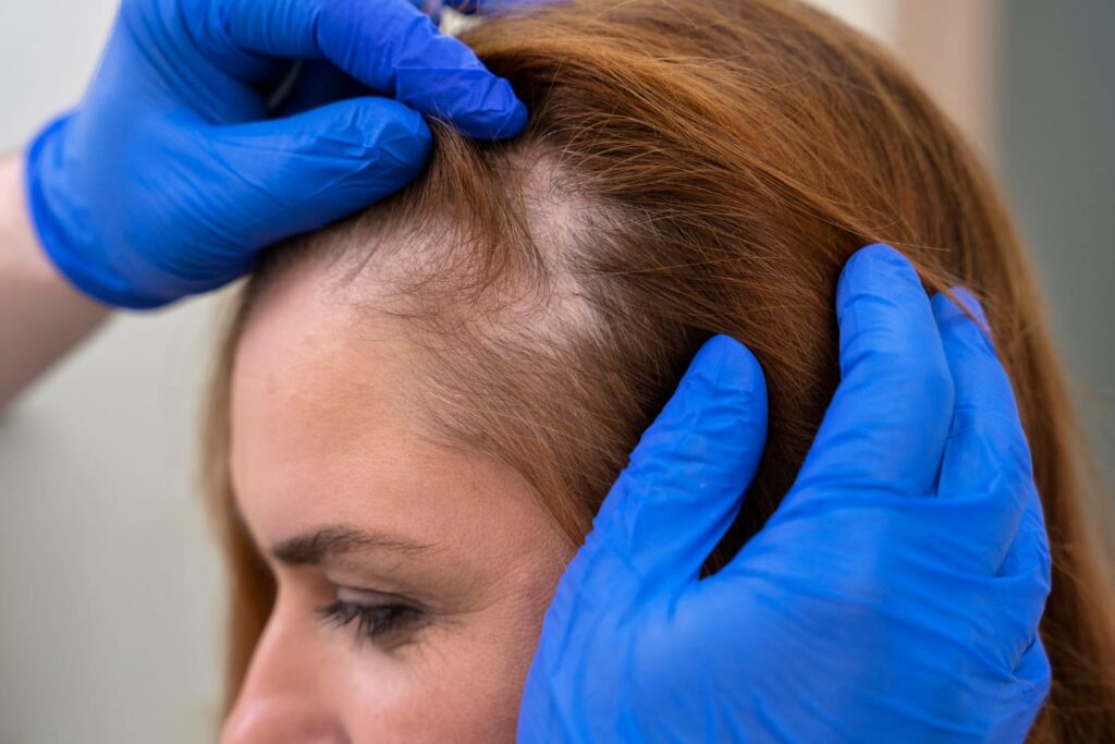 Vor der Haartransplantation lässt eine Frau ihr Haar in einer Klinik in Deutschland untersuchen.