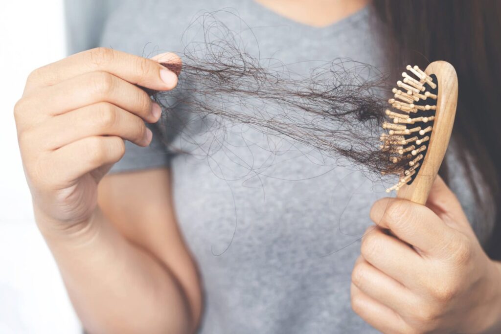 Eine junge Frau, die unter Haarausfall leidet, hält einen Kamm in der Hand.