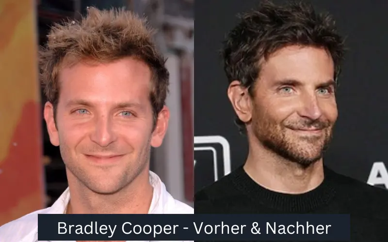 Bradley Cooper Haartransplantationen