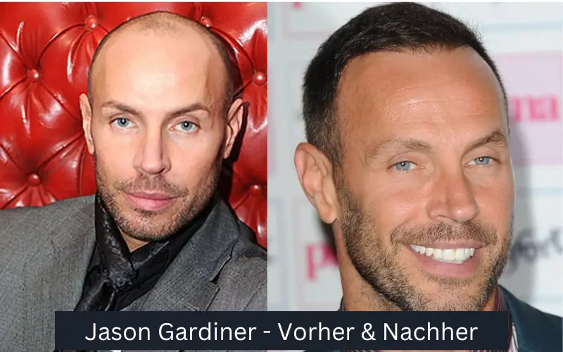 Jason Gardiner vorher und nachher
