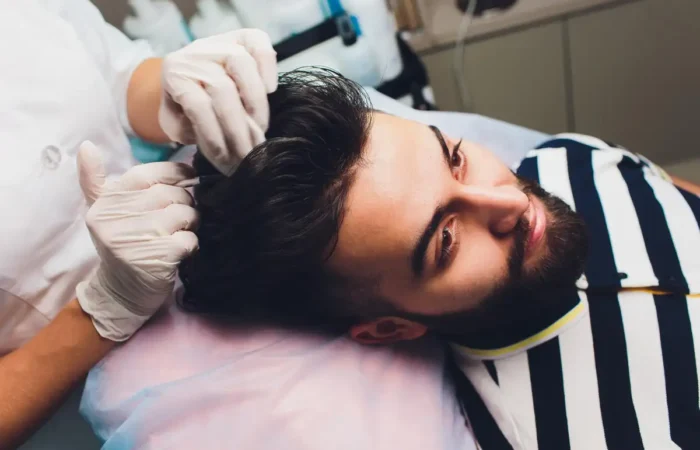 Eine Person, die sich nach einer Haartransplantation einer Pflegebehandlung unterzieht.